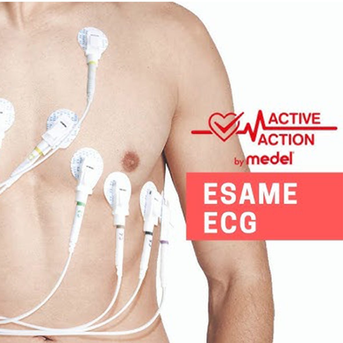 ecg